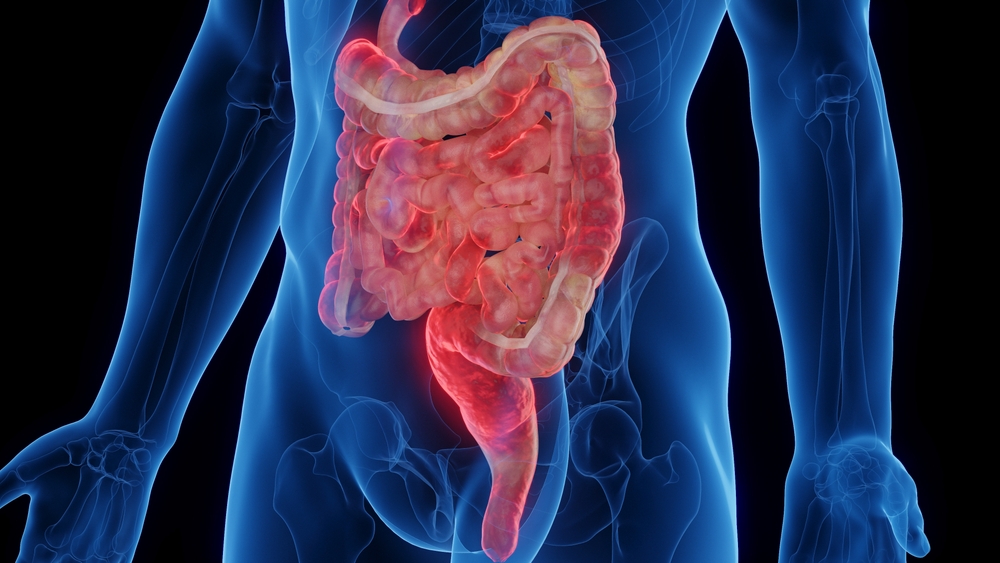 Choroba Crohna to chroniczny stan zapalny wybranych odcinków jelit. Fot. SciePro/Shutterstock