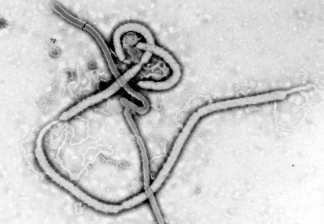 Wirus Ebola (EBOV). By CDC/ Dr. Frederick A. Murphy [Public domain], via Wikimedia Commons