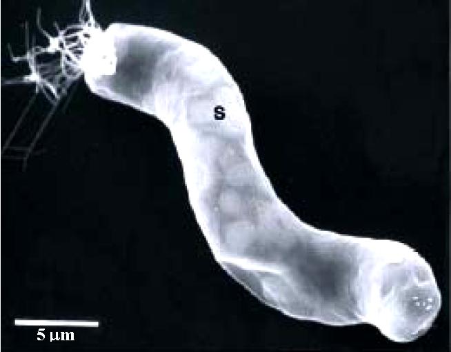 Ogromna bakteria Titanospirillum velox. Image 1.e Courtesy: Dr. Riccardo Guerrero/journalofcosmology.com