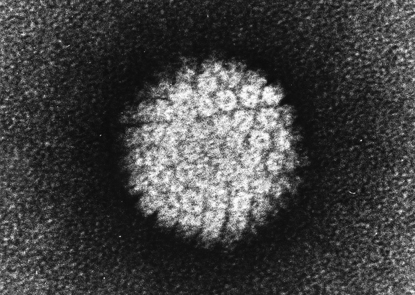 HPV w obrazie mikroskopu elektronowego, źródło: Laboratory of Tumor Virus Biology