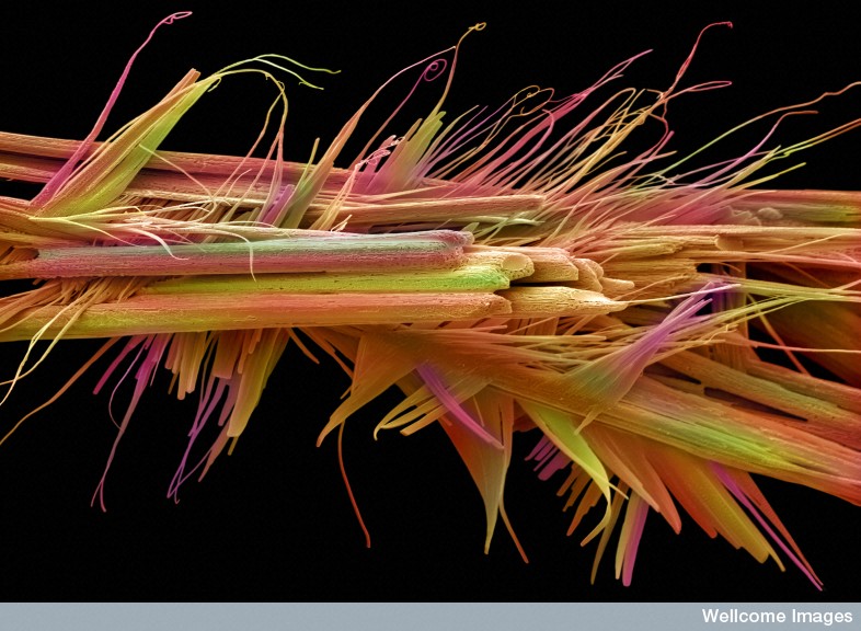 Kryształ kofeiny, fot. Annie Cavanagh and David McCarthy, źródło: www.wellcomeimageawards.org