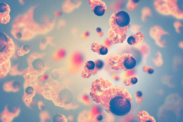 Komórki rakowe. Źródło: shutterstock