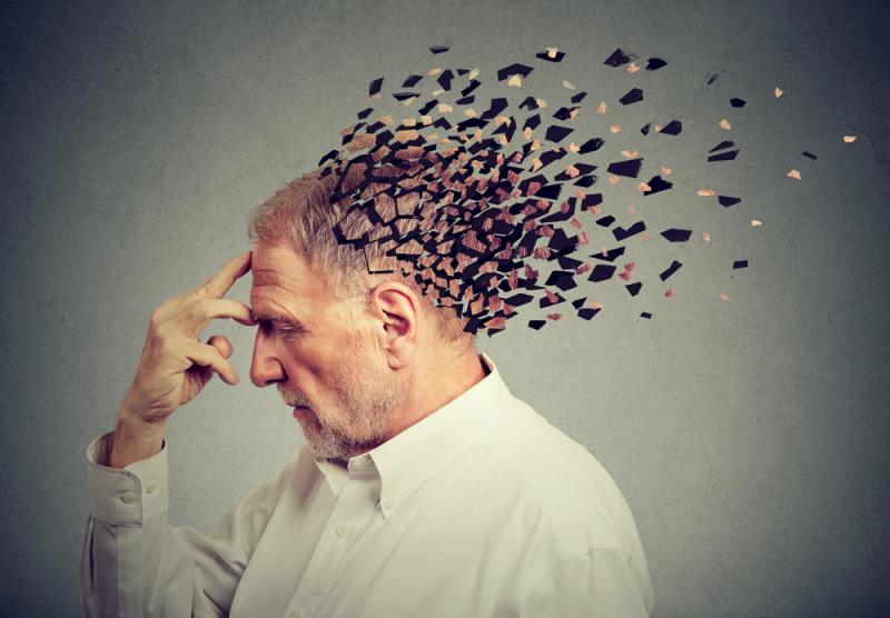 Choroba Alzheimera asocjowana jest z zaburzeniami produkcji neuroprzekaźników. Źródło: pathdoc/Shutterstock