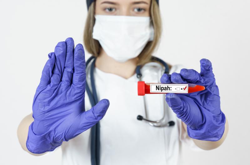 Istnieją już testy łatwo potwierdzające zakażenie wirusem Nipah. Źródło: SkazovD/Shutterstock