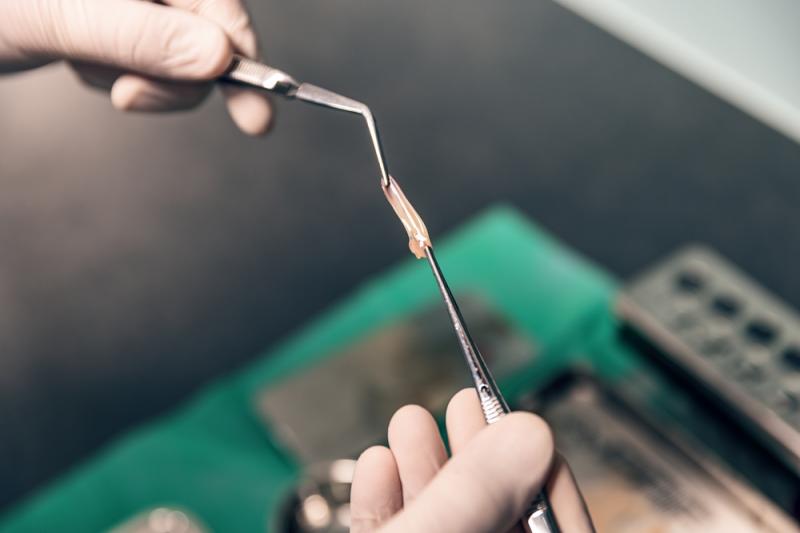 Strukturalna fibryna bogatopłytkowa ma postać ciała stałego, fot. grafvision/Shutterstock