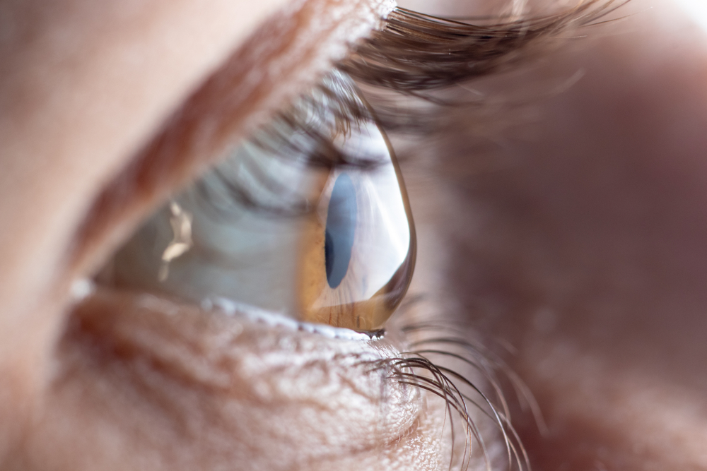 Astygmatyzm to zaburzenia krzywizny rogówki lub soczewki oka, fot. Garna Zarina/Shutterstock