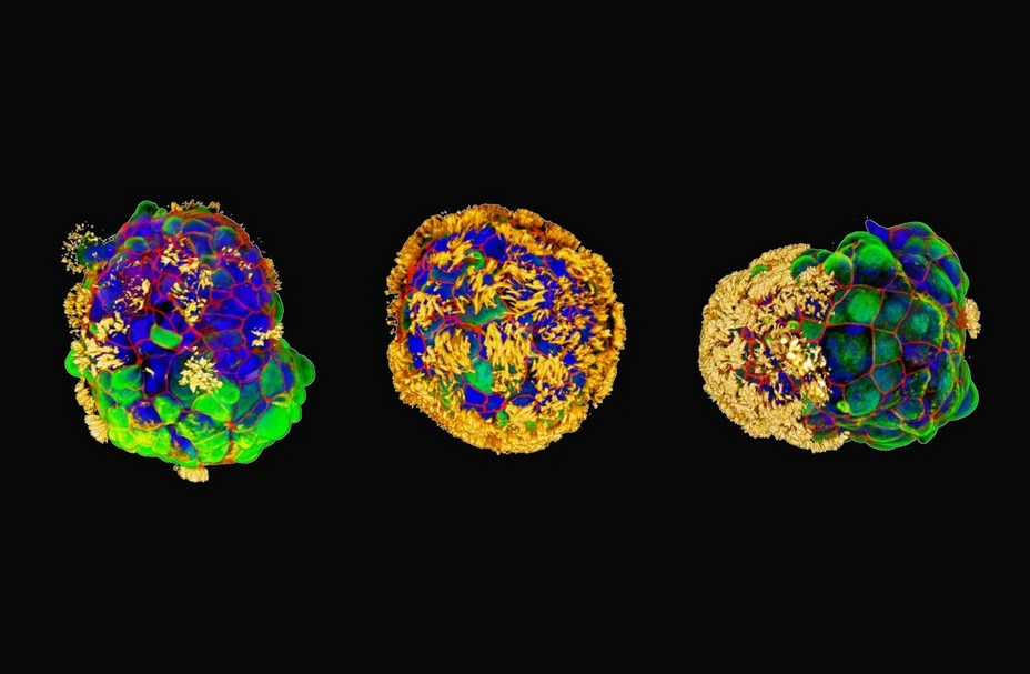 Przykłady Anthrobotów z rzęskami przypominającymi włosy w kolorze żółtym. Autorka zdjęcia: Gizem Gumuskaya