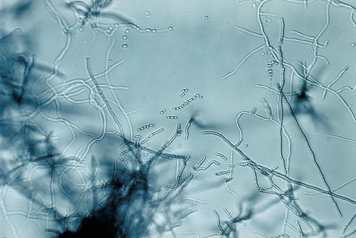 Streptomyces – rodzaj w rzędzie Actinomycetales, tlenowe bakterie Gram-dodatnie w rzędzie promieniowców