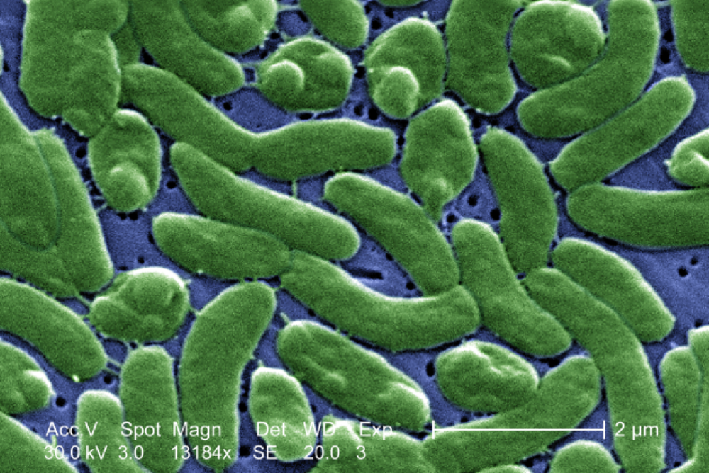 Zdjęcie mikroskopowe bakterii Vibrio vulnificus